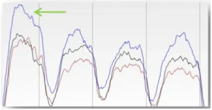 Figure 19 Schematic Diagram of Excessive Heat Transfer at Fixed Edge Figure 19 Schematic Diagram of Excessive Heat Transfer at Fixed Edge